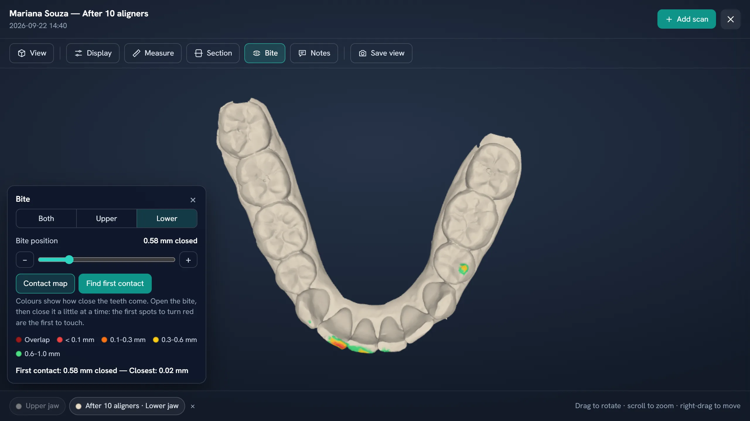 3D scans and CT